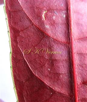  Abaxial surface of leaf